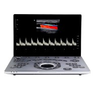 Ultrasonido Portátil SonoAir-60 encendido